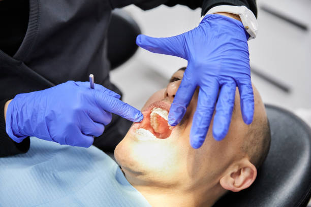 Best Dental Abscess Treatment in American Fork, UT